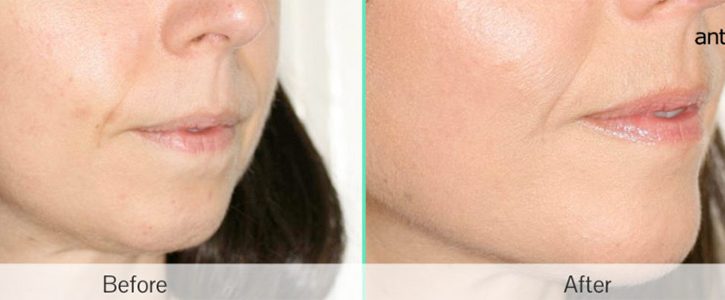 Global-Lips-2